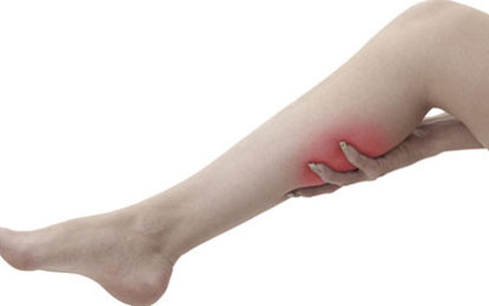 Chuột rút co cứng - Hình ảnh minh họa